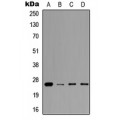 LifeSab™ Prolactin Rabbit pAb (50 µl)