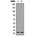 LifeSab™ PXMP2 Rabbit pAb (50 µl)