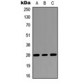 LifeSab™ RASSF3 Rabbit pAb (50 µl)