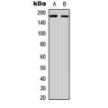 LifeSab™ RET Rabbit pAb (50 µl)