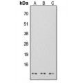 LifeSab™ S100-A7 Rabbit pAb (50 µl)