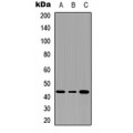 LifeSab™ Serpin B3/4 Rabbit pAb (50 µl)