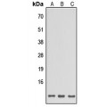 LifeSab™ SPINK6 Rabbit pAb (50 µl)