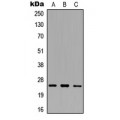 LifeSab™ SRA Rabbit pAb (50 µl)