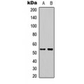 LifeSab™ STEAP3 Rabbit pAb (50 µl)