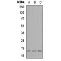 LifeSab™ SYT8 Rabbit pAb (50 µl)