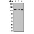LifeSab™ TBC1D2 Rabbit pAb (50 µl)