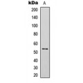 LifeSab™ p53 (pS392) Rabbit pAb (50 µl)