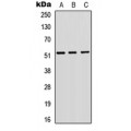 LifeSab™ VIPR1 Rabbit pAb (50 µl)
