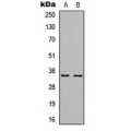 LifeSab™ Cyclin D1 (pT286) Rabbit pAb (50 µl)