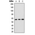 LifeSab™ p57 Kip2 Rabbit pAb (50 µl)