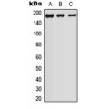 LifeSab™ HER2 Rabbit pAb (50 µl)