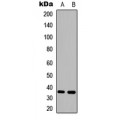 LifeSab™ HSD11B1 Rabbit pAb (50 µl)