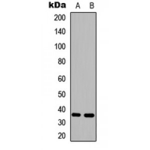 LifeSab™ HSD11B1 Rabbit pAb (50 µl)