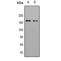 LifeSab™ LMTK3 Rabbit pAb (50 µl)