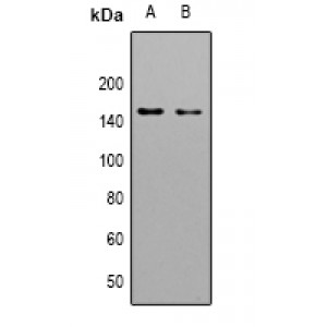LifeSab™ LMTK3 Rabbit pAb (50 µl)