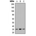 LifeSab™ NDUFS3 Rabbit pAb (50 µl)