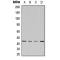 LifeSab™ Kappa Opioid Receptor (pS369) Rabbit pAb (50 µl)