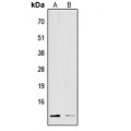 LifeSab™ S100-A16 Rabbit pAb (50 µl)