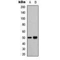 LifeSab™ SMYD2 Rabbit pAb (50 µl)
