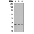 LifeSab™ ATP5H Rabbit pAb (50 µl)