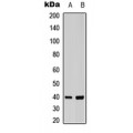 LifeSab™ CCR11 Rabbit pAb (50 µl)