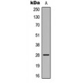 LifeSab™ ELOVL5 Rabbit pAb (50 µl)
