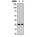 LifeSab™ FGF19 Rabbit pAb (50 µl)