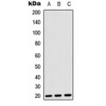 LifeSab™ FGF22 Rabbit pAb (50 µl)