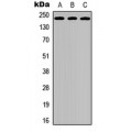 LifeSab™ VEGFR2 Rabbit pAb (50 µl)