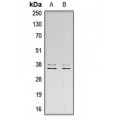 LifeSab™ LAT (pY200) Rabbit pAb (50 µl)
