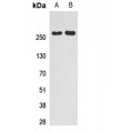 LifeSab™ SMRT Rabbit pAb (50 µl)