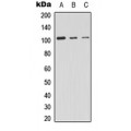LifeSab™ PRKD2 Rabbit pAb (50 µl)