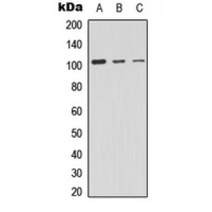 LifeSab™ PRKD2 Rabbit pAb (50 µl)