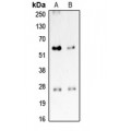 LifeSab™ CD201 Rabbit pAb (50 µl)