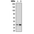 LifeSab™ PGD2 Receptor Rabbit pAb (50 µl)