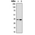 LifeSab™ RAD51A (pY315) Rabbit pAb (50 µl)