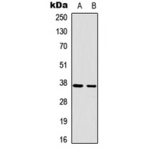 LifeSab™ RAD51A Rabbit pAb (50 µl)