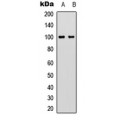 LifeSab™ VAV2 (pY142) Rabbit pAb (50 µl)