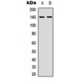 LifeSab™ ZC3H4 Rabbit pAb (50 µl)