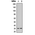 LifeSab™ DHRS11 Rabbit pAb (50 µl)
