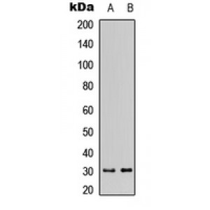 LifeSab™ DHRS11 Rabbit pAb (50 µl)