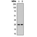 LifeSab™ FGF13 Rabbit pAb (50 µl)