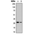 LifeSab™ Granzyme K Rabbit pAb (50 µl)