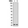 LifeSab™ CD278 Rabbit pAb (50 µl)