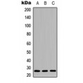 LifeSab™ IL-26 Rabbit pAb (50 µl)