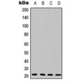 LifeSab™ IL-6 Rabbit pAb (50 µl)