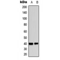 LifeSab™ EP2 Rabbit pAb (50 µl)