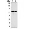 LifeSab™ HSN1 Rabbit pAb (50 µl)