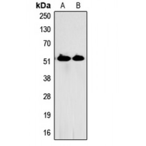 LifeSab™ HSN1 Rabbit pAb (50 µl)